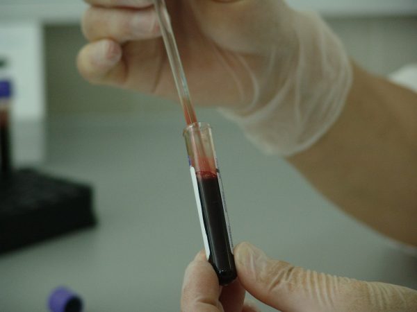 estudiar ingenieria bioquimica guia completa 2024