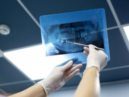 odontologia ula licenciatura en cirujano dentista